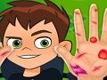 Laro Ben10 na Doctor ng Kamay  online