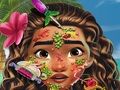 Laro Doktor ng balat ng Moana online
