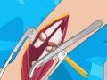 Laro Surgery ng braso 2  online