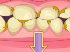 Laro Bad Teeth Makeover online