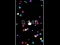 Laro Pop Ball online