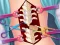 Laro Anna Scoliosis Surgery online