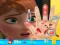 Laro Anna hand doctor online