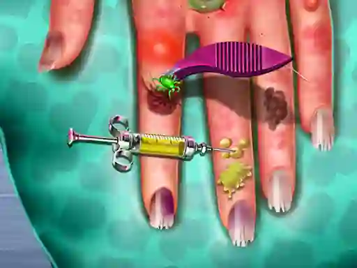 Laro Hand Skin Doctor online