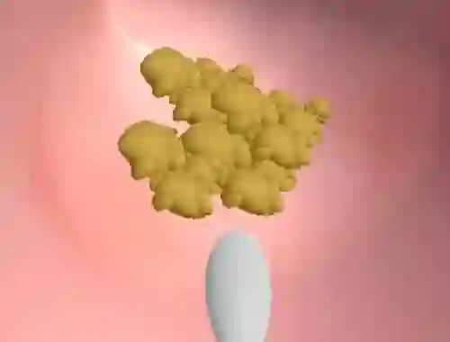 Laro Earwax Clinic online