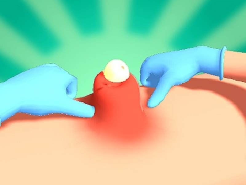 Laro Pimple pisilin online