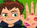 Laro Ben10 na Doctor ng Kamay  online