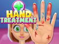 Laro Paggamot sa Kamay  online