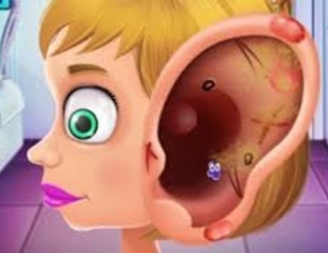 Laro Ang doktor ng mga bata na nagpapagamot ng mga tainga  online